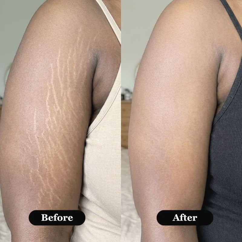 Marisae™ Retinal Skin Boost Serum