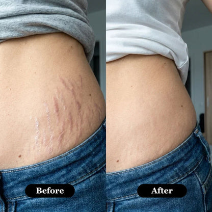 Marisae™ Retinal Skin Boost Serum